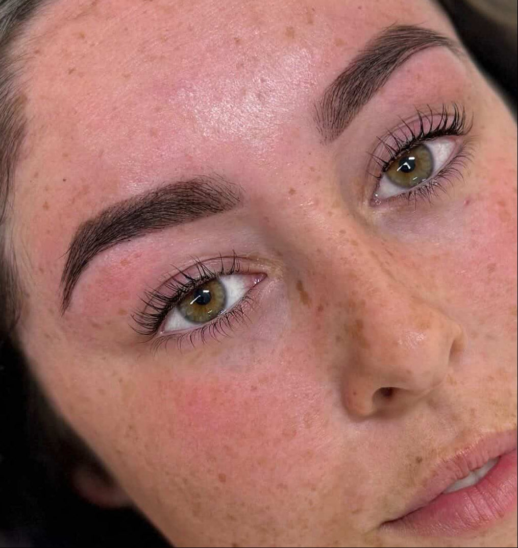 Close-up of a person's face with freckles and brown eyes.